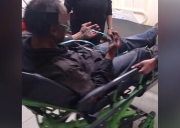 Hombre resulta con quemaduras en el rostro luego de que su vivienda se incendiara