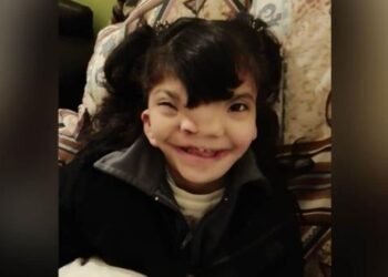 Gina, pequeña con malformación necesita apoyo; su madre vende chocolates