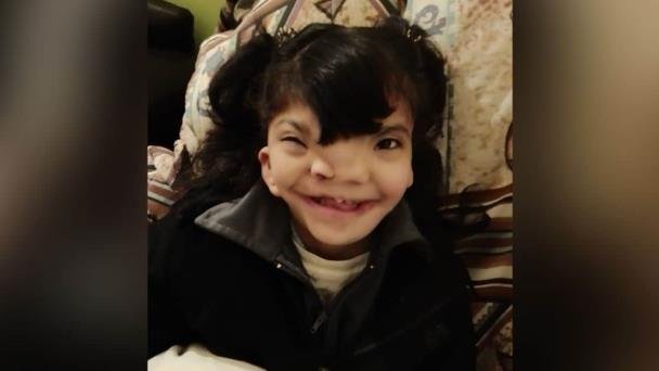 Gina, pequeña con malformación necesita apoyo; su madre vende chocolates Gina, pequeña con malformación necesita apoyo; su madre vende chocolates