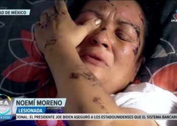 Mujer quedó postrada en una cama tras ser atropellada | Noticias Francisco Zea | Programa 14/03/2023