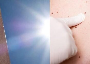 ¡Cuídate del sol! Llaman a protegerse contra el cáncer de piel