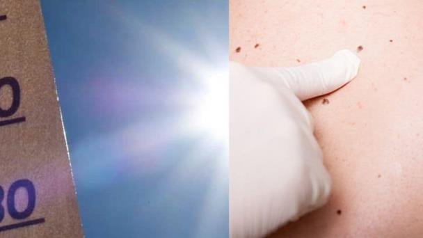 ¡Cuídate del sol! Llaman a protegerse contra el cáncer de piel ¡Cuídate del sol! Llaman a protegerse contra el cáncer de piel