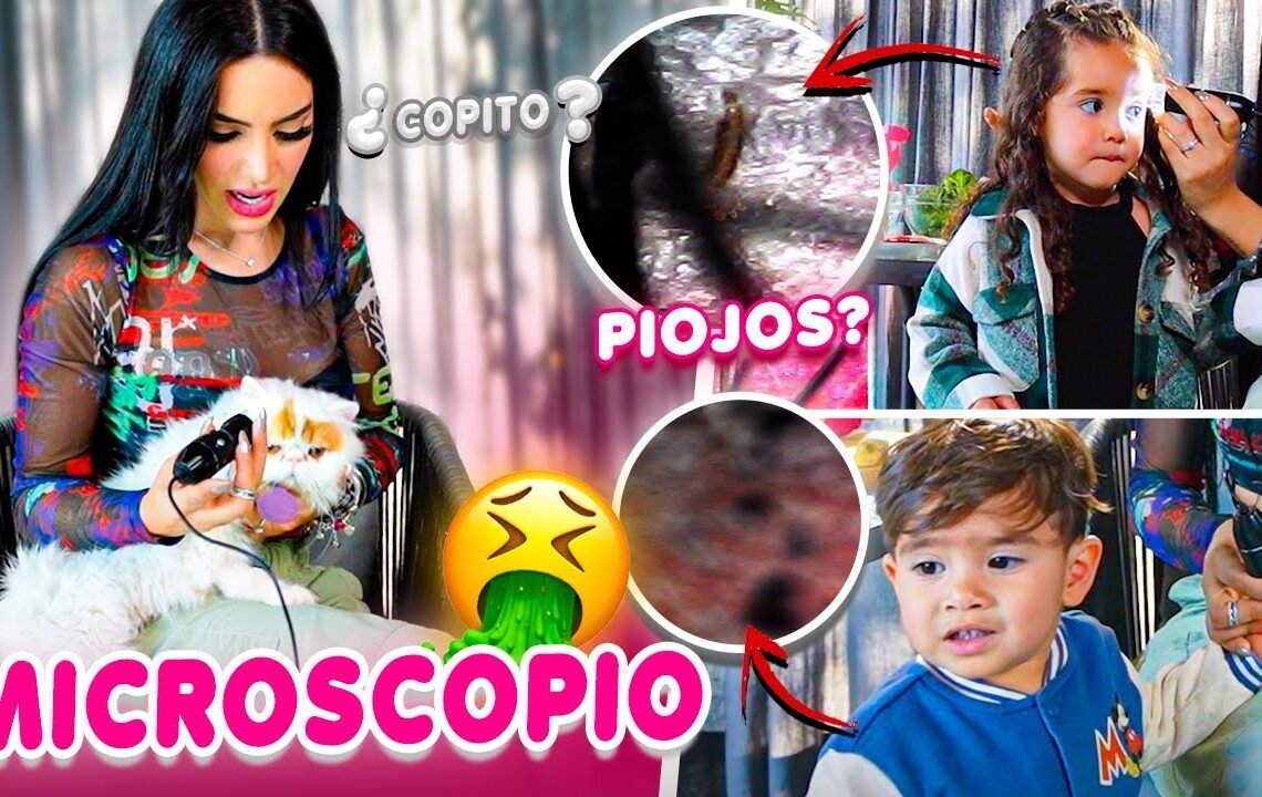 ASÍ NOS VEMOS BAJO EL MICROSCOPIO 😱 Kimberly Loaiza