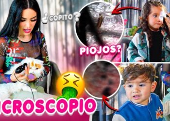 ASÍ NOS VEMOS BAJO EL MICROSCOPIO 😱 Kimberly Loaiza