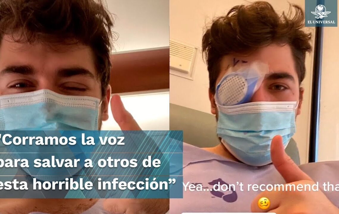 “Parásitos se comieron mi ojo”: Se queda ciego por tomar siesta con lentes de contacto
