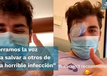 “Parásitos se comieron mi ojo”: Se queda ciego por tomar siesta con lentes de contacto