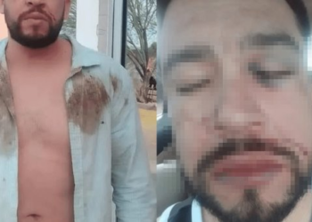 “Hasta balazos me tiraron”: denuncia presunto abuso policial en San Pedro