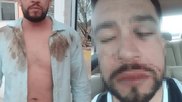 “Hasta balazos me tiraron”: denuncia presunto abuso policial en San Pedro “Hasta balazos me tiraron”: denuncia presunto abuso policial en San Pedro