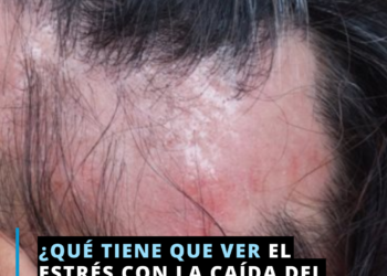 El estrés y la caída del cabello