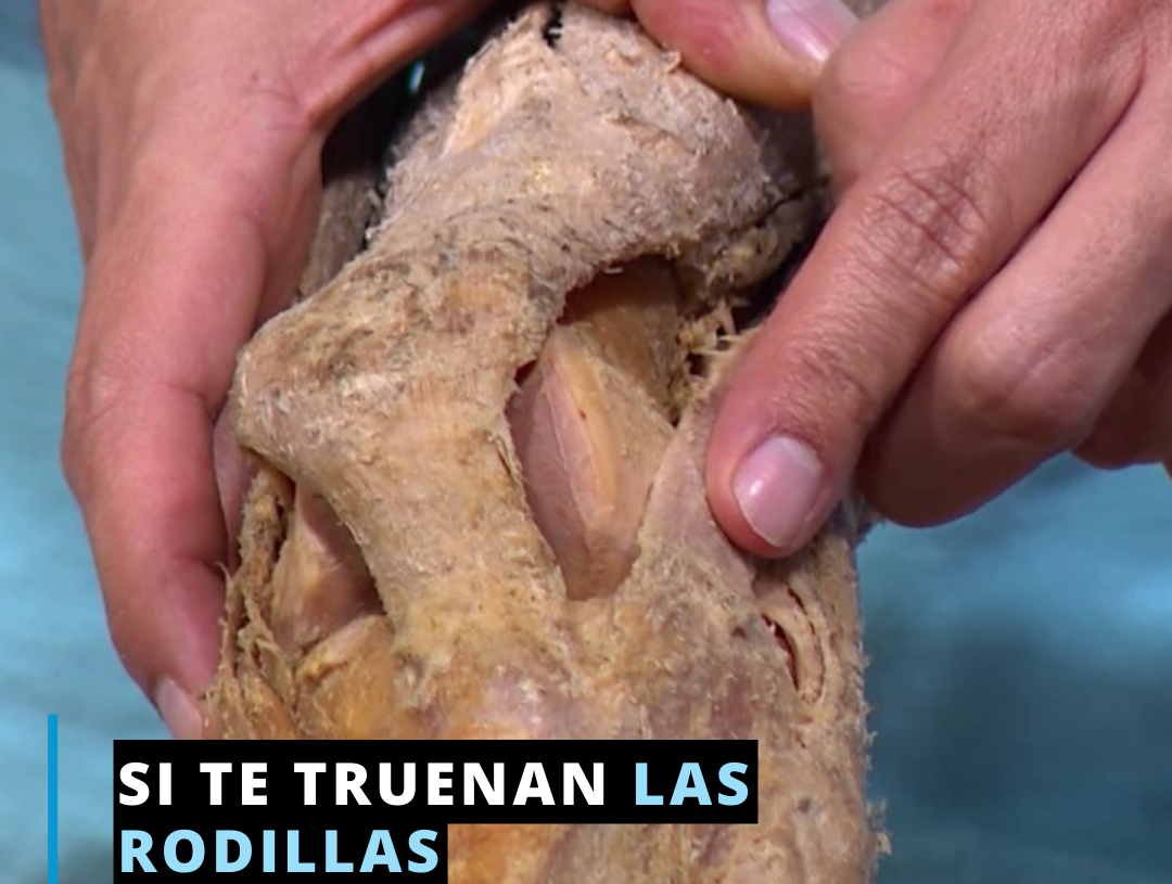 Si te truenan las rodillas Si te truenan las rodillas