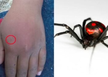 Niño de 8 años se deja picar por viuda negra para convertirse en Spiderman