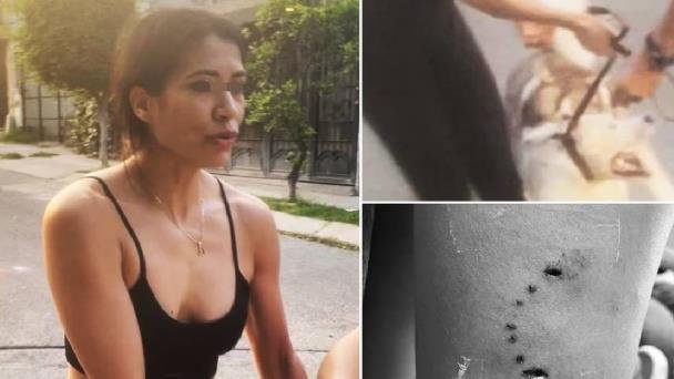 Denuncian a mujer que ordenó a su husky matar a otro perro en Jalisco Denuncian a mujer que ordenó a su husky matar a otro perro en Jalisco