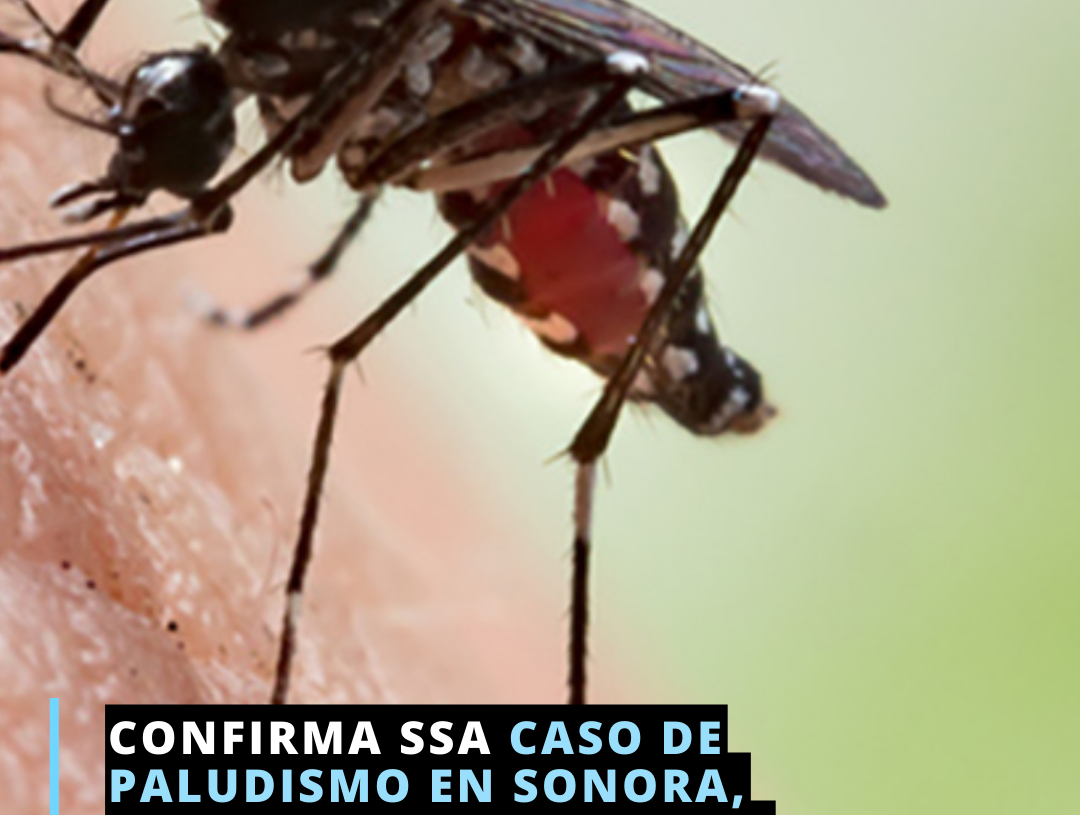 Detecta SSA caso de paludismo en migrante africano en Sonora Detecta SSA caso de paludismo en migrante africano en Sonora
