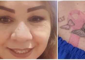 Blanca Zulema perdió un seno por el cáncer y sigue su lucha