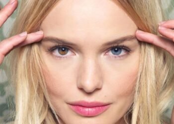 Celebridades con Heterocromía: Ojos de Diferentes Colores