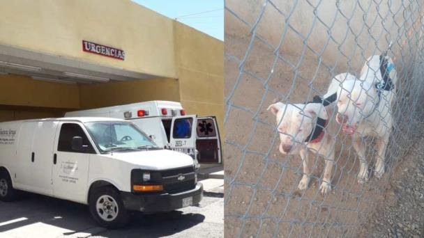 Menor de 6 años queda grave tras ser atacado por dos perros pitbull Menor de 6 años queda grave tras ser atacado por dos perros pitbull