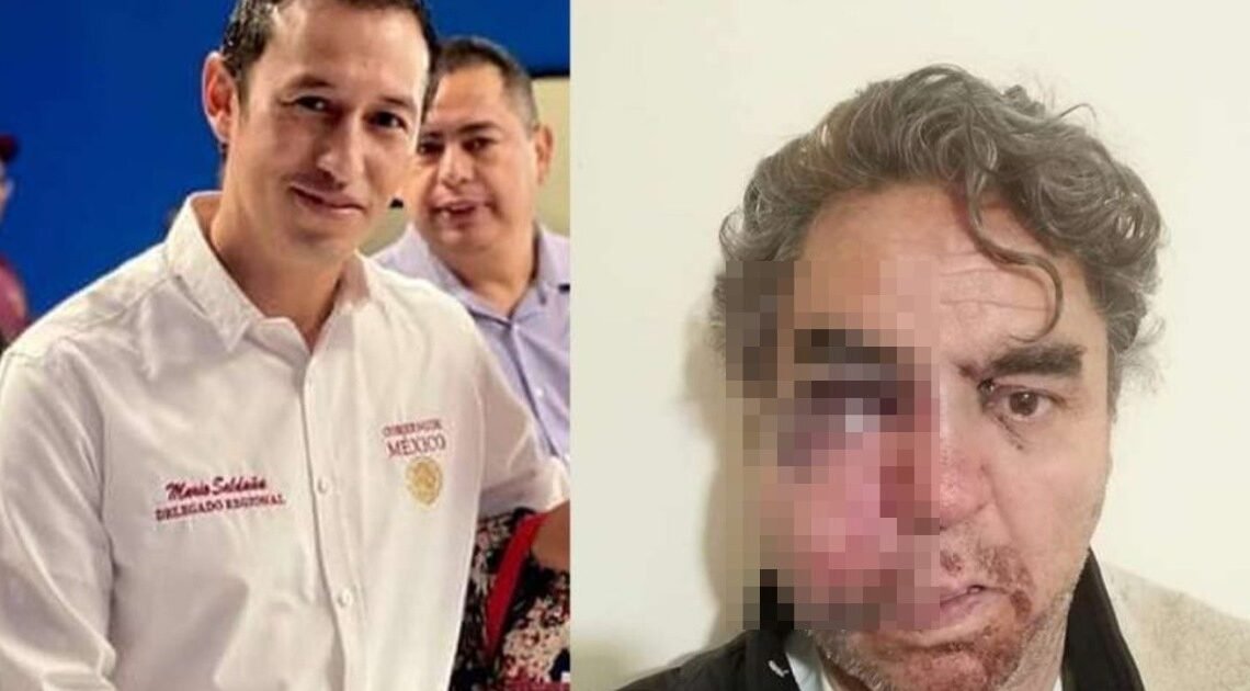 Periodista es brutalmente golpeado en cobertura de Festival Navideño en Chihuahua; señalan a Delegado de Bienestar como responsable de las agresiones