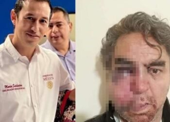 Periodista es brutalmente golpeado en cobertura de Festival Navideño en Chihuahua; señalan a Delegado de Bienestar como responsable de las agresiones