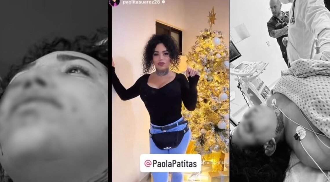 Paola Suárez a punto de perder su ojo y con dos costillas rotas tras ser golpeada por su prometido Paola Suárez a punto de perder su ojo y con dos costillas rotas tras ser golpeada por su prometido