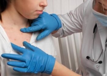 Detectan casos sospechosos de sarampión en Sonora