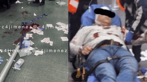 Apuñalan a venezolano en el aeropuerto de la Ciudad de México Apuñalan a venezolano en el aeropuerto de la Ciudad de México