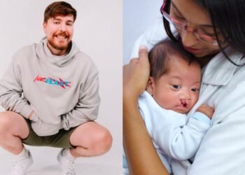 Mr. Beast dona cirugías para niños mexicanos con labio leporino