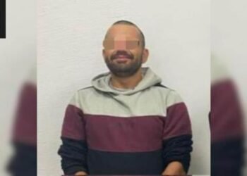 Procesan a hombre por presuntamente quemar los muslos de su expareja