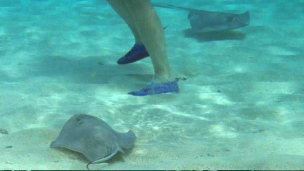 ¿Qué hacer si te pica una mantarraya? Doctora emite recomendaciones ¿Qué hacer si te pica una mantarraya? Doctora emite recomendaciones