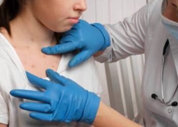 Aumentan posibles casos de sarampión en México y Sonora