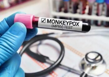 Lo que debes saber sobre la viruela del mono