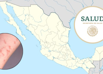 ¿Cuántos casos de viruela del mono hay en México? Semana 33