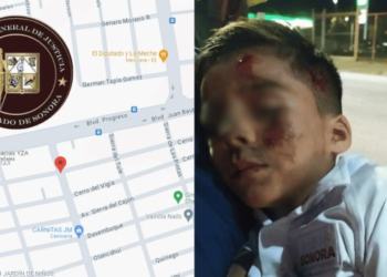 Said Parra, niño atropellado en Hermosillo; FGJE investiga