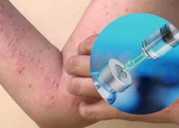Ssa espera aprobación para vacuna contra Mpox