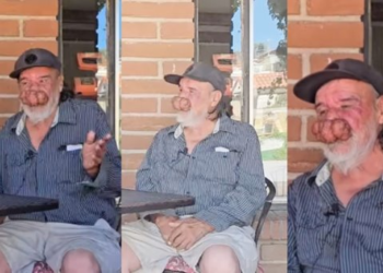 El ‘Pichón’ López busca apoyo urgente para su operación