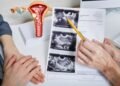 Actualizan nombre del síndrome de ovario poliquístico por razones médicas